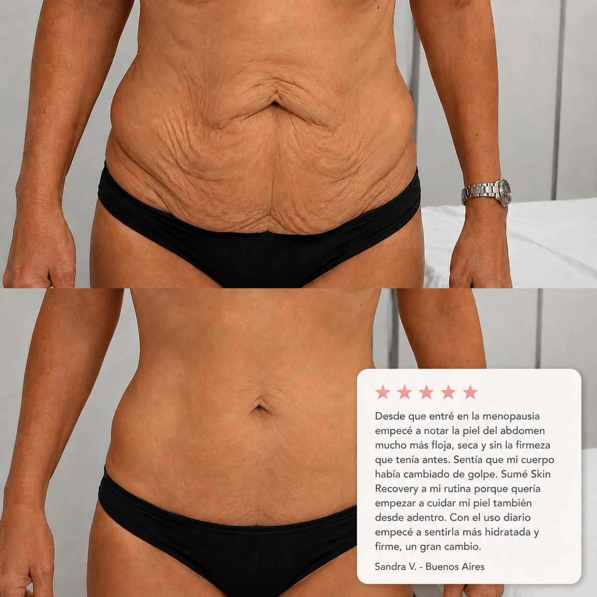 SKIN RECOVERY - REAFIRMANTE CORPORAL MENOPAUSIA